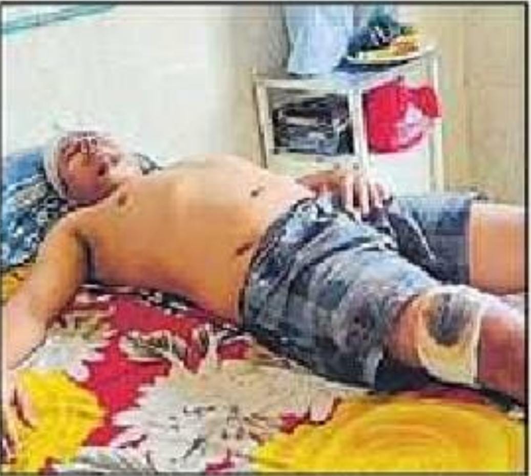 पुरानी दुश्मनी को लेकर युवक पर चाकू से किया गया हमला।