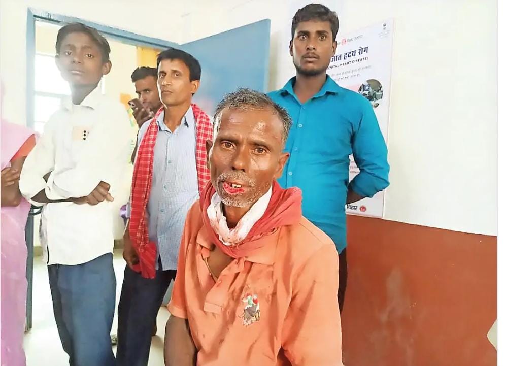 पत्नी के साथ दुर्व्यवहार करने का पति ने किया विरोध तो अपराधी ने काटा पति का होंठ