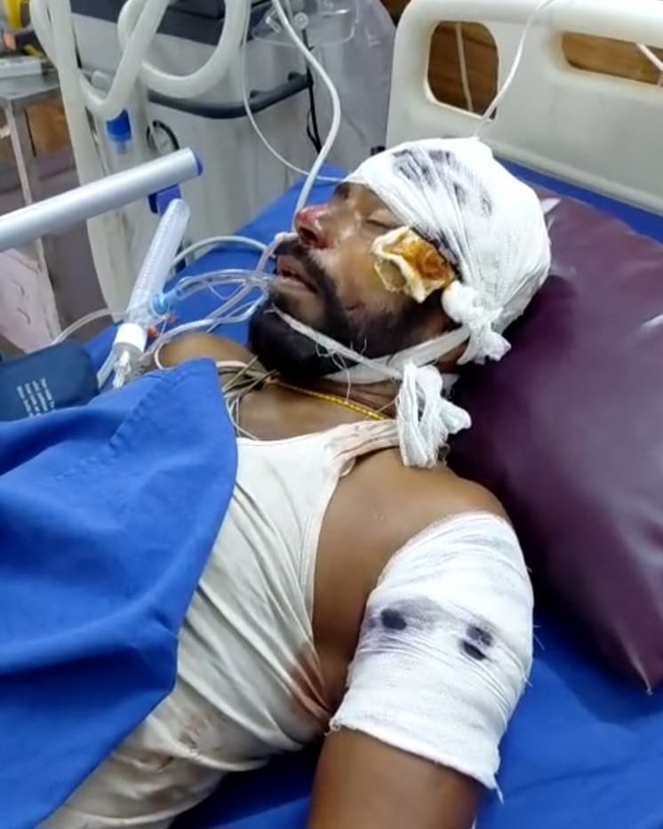 लौंरिया में नाइट गार्ड को अज्ञात कार ने मारी टक्कर, कार के टक्कर से लगभग 20 फिट उड़ा नाइट गार्ड।